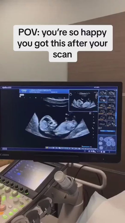 Electronic Photo Album Video Advisement